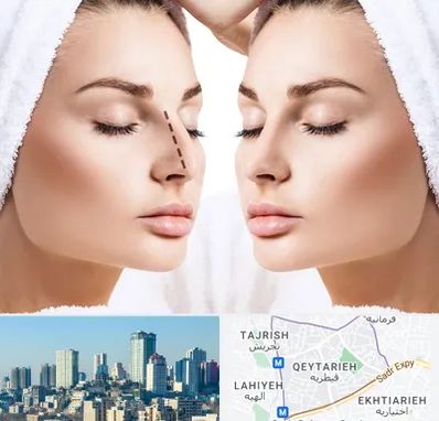 عمل بینی در قیطریه