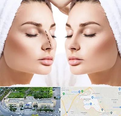 عمل بینی در نسیم شهر