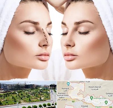 عمل بینی در پردیس