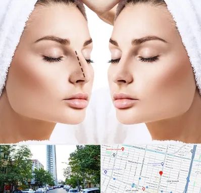 عمل بینی در امامت مشهد