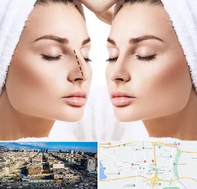 عمل بینی در شهرک راه آهن