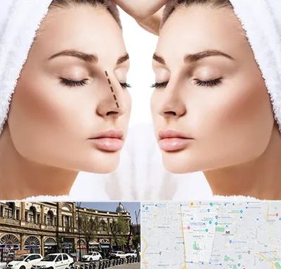 عمل بینی در منطقه 11 تهران