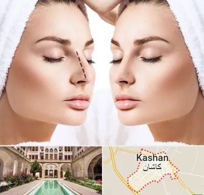 عمل بینی در کاشان