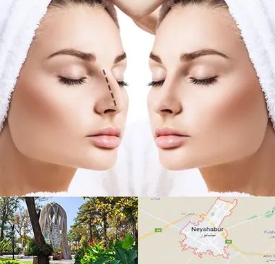 عمل بینی در نیشابور