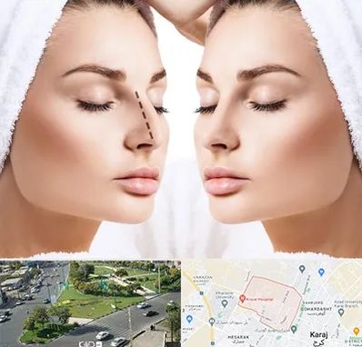 عمل بینی در شاهین ویلا کرج