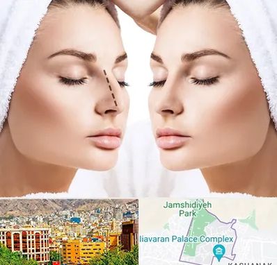 عمل بینی در نیاوران