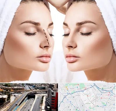 عمل بینی در ستارخان شیراز