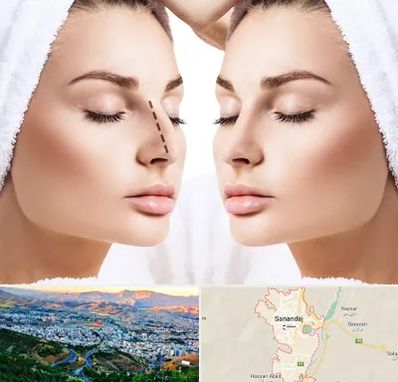 عمل بینی در سنندج