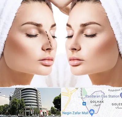 عمل بینی در قلهک