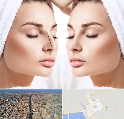 عمل بینی در بندر ماهشهر