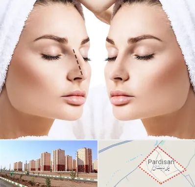 عمل بینی در پردیسان قم