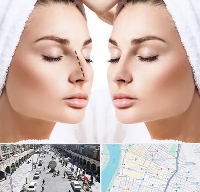 عمل بینی در نادری اهواز