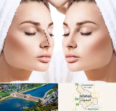 عمل بینی در اصفهان