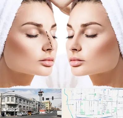 عمل بینی در 17شهریور