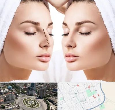 عمل بینی در زرافشان اسلامشهر