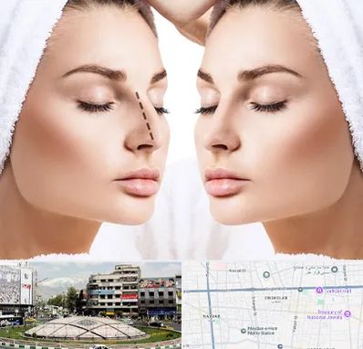 عمل بینی در مرکز تهران