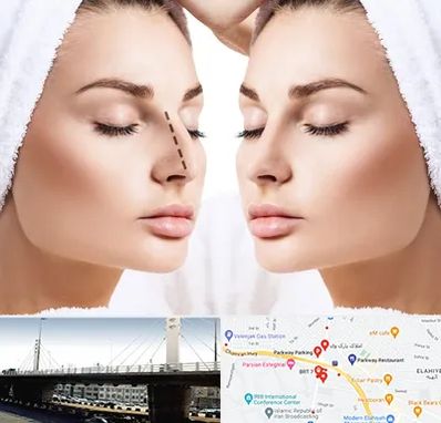 عمل بینی در پارک وی