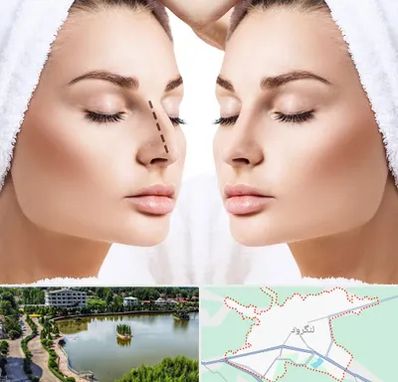 عمل بینی در لنگرود