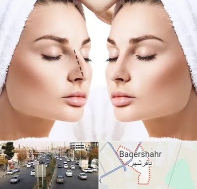 عمل بینی در باقرشهر