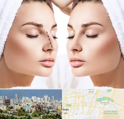 عمل بینی در شرق تهران