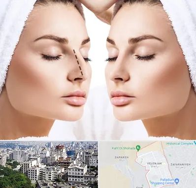 عمل بینی در ولنجک