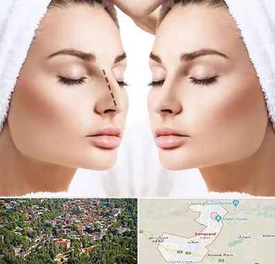 عمل بینی در دماوند