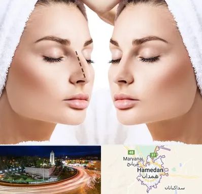 عمل بینی در همدان