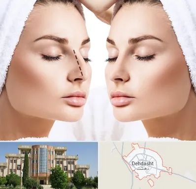 عمل بینی در دهدشت