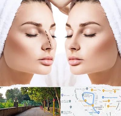 عمل بینی در بلوار گیلان رشت