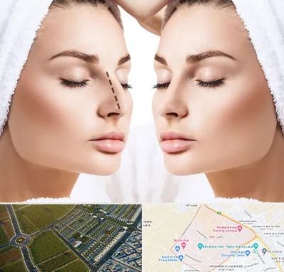 عمل بینی در الهیه مشهد