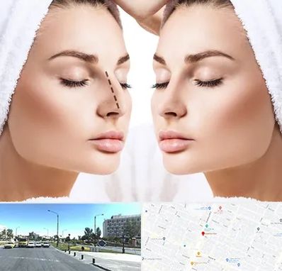 عمل بینی در بلوار کلاهدوز مشهد