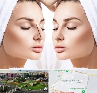 عمل بینی در تهرانسر