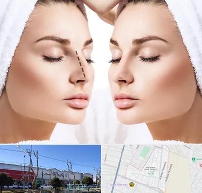عمل بینی در فاز دو اندیشه
