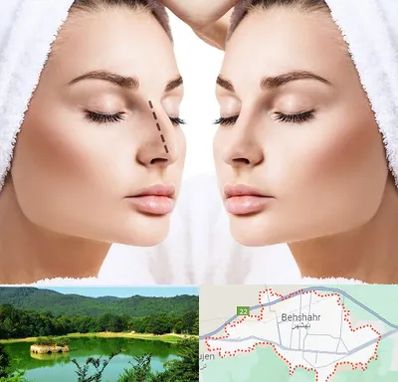 عمل بینی در بهشهر