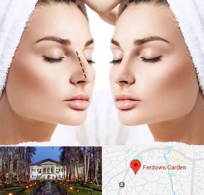 عمل بینی در باغ فردوس