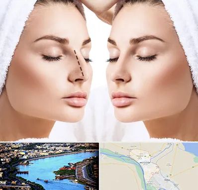 عمل بینی در خرمشهر