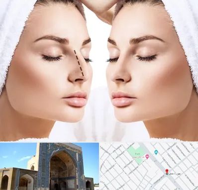 عمل بینی در مصلی مشهد