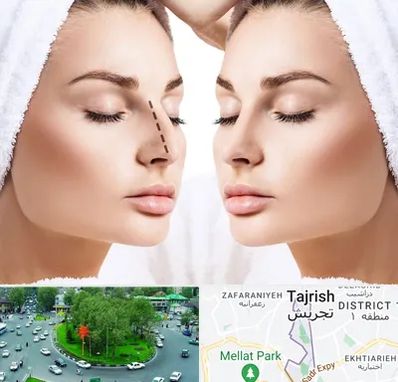 عمل بینی در تجریش