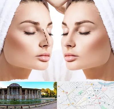 عمل بینی در عفیف آباد شیراز