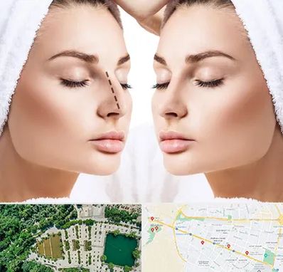 عمل بینی در وکیل آباد مشهد