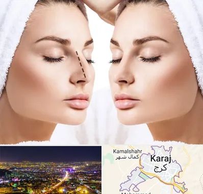 عمل بینی در کرج