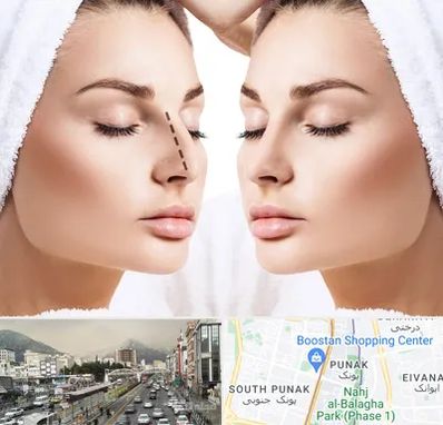 عمل بینی در پونک