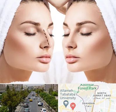 عمل بینی در شهران