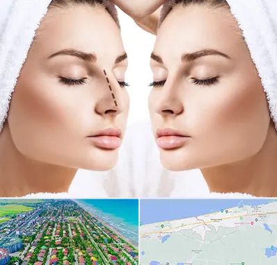 عمل بینی در فریدونکنار