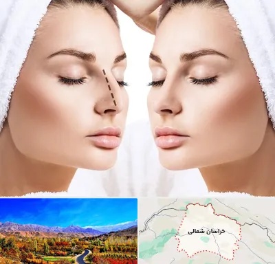 عمل بینی در خراسان شمالی