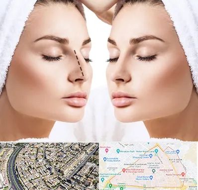 عمل بینی در شهرک غرب مشهد