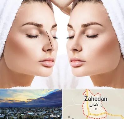 عمل بینی در زاهدان