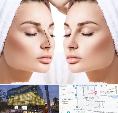 عمل بینی در جمهوری