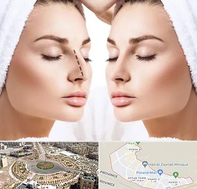 عمل بینی در پرند