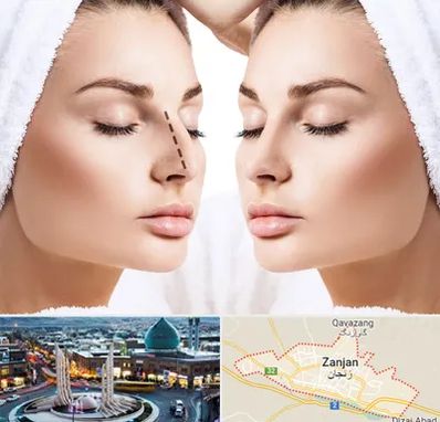 عمل بینی در زنجان